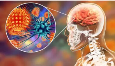 Ghana Health Service warns of possible outbreak of meningitis