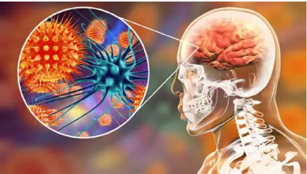 Ghana Health Service warns of possible outbreak of meningitis