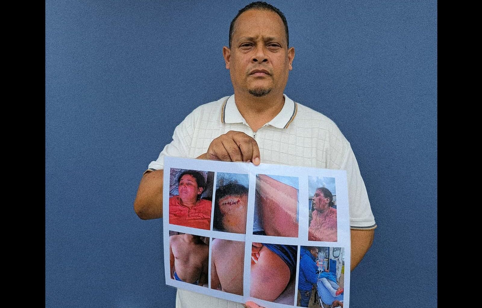 WATCH | Pastor’s wife beaten in home attack, suspects walk free on bail