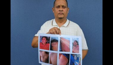 WATCH | Pastor’s wife beaten in home attack, suspects walk free on bail