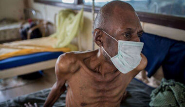 Tuberculosis-patient