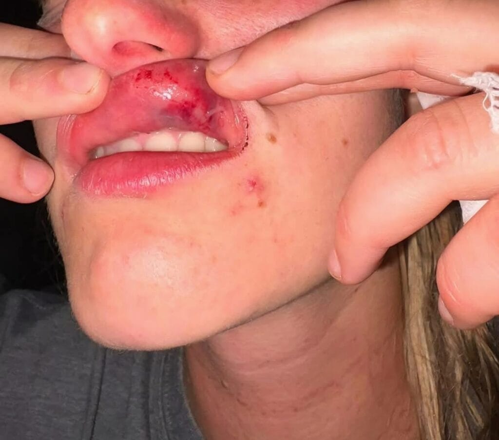One of the woman showing a wound to her lip. Photo from Brad Nathanson Investigations Facebook