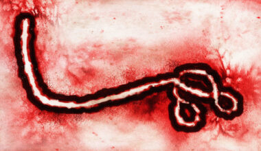 Ebola-related virus in Ethiopia has the WHO highly concerned