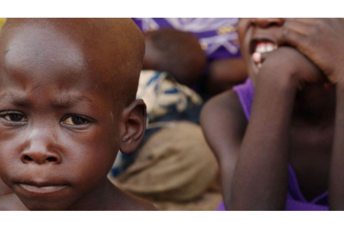 Why food-rich regions struggle with severe child malnutrition