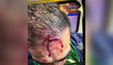 ecchymoses, points de suture, dix jours d'ITT... un homme tabassé lors du match Algérie-Nigéria