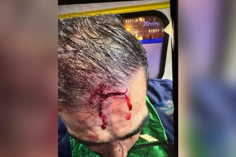 ecchymoses, points de suture, dix jours d'ITT... un homme tabassé lors du match Algérie-Nigéria