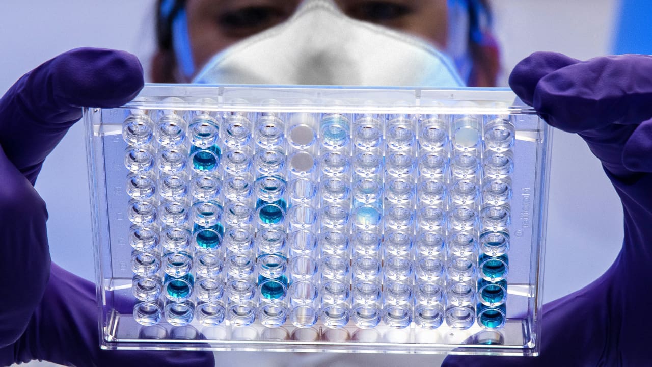 Widespread concern for deadly bat-transmitted virus in South Africa