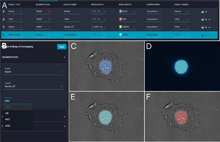 A) Screenshot of the IN Carta analysis workflow. B) Screenshot of setting the user-defined target. C) Overlapping of the Nuclei (blue) mask and the TL image. D) Overlapping of Nuclei_GT (green) and the DAPI image. E) Overlapping of Nuclei (blue), Nuclei_GT (green), and the TL image. F) Overlapping of Overlapping (red) and the TL image.