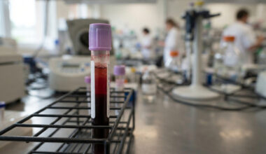 Vitamin-D-Mangel verstärkt stille Entzündungen im Körper