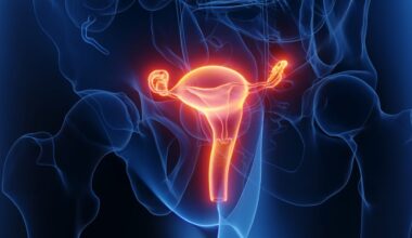 Endometriose: Studie zeigt 46 Prozent höheres Diabetesrisiko | Leben & Wissen