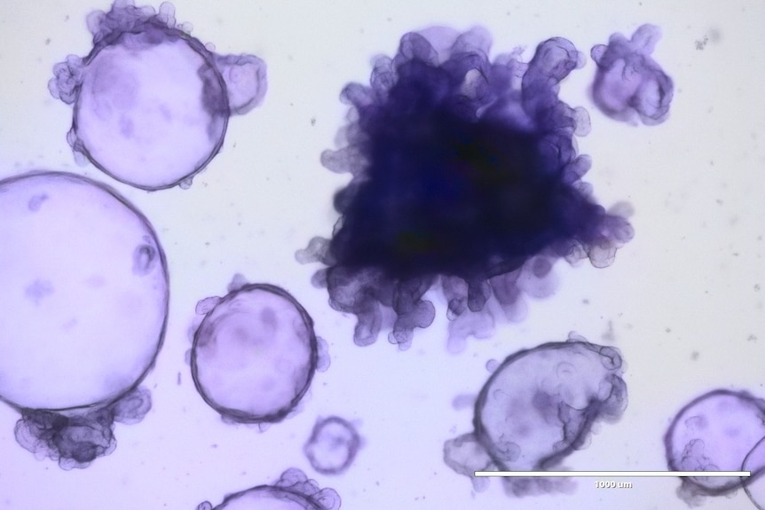 purple circles and darker purple matter seen under a microscope