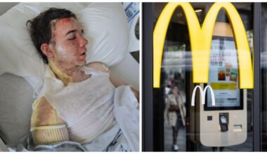 « La douleur est tellement atroce » : l’horreur au McDonald’s, Jacob grièvement brûlé après une attaque à l’huile bouillante par un collègue !