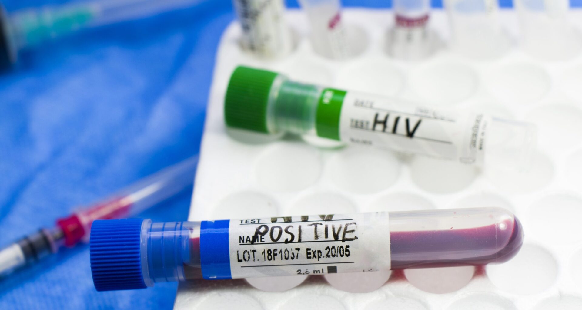 VIH : cinq fois plus de personnes qu'en 2019 vivent avec à Mayotte