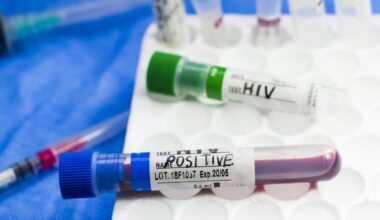 VIH : cinq fois plus de personnes qu'en 2019 vivent avec à Mayotte