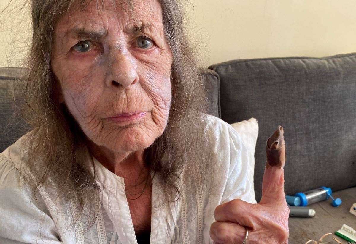 Lydd grandmother told to call an ambulance after cutting finger and being turned away from GP surgery and pharmacist