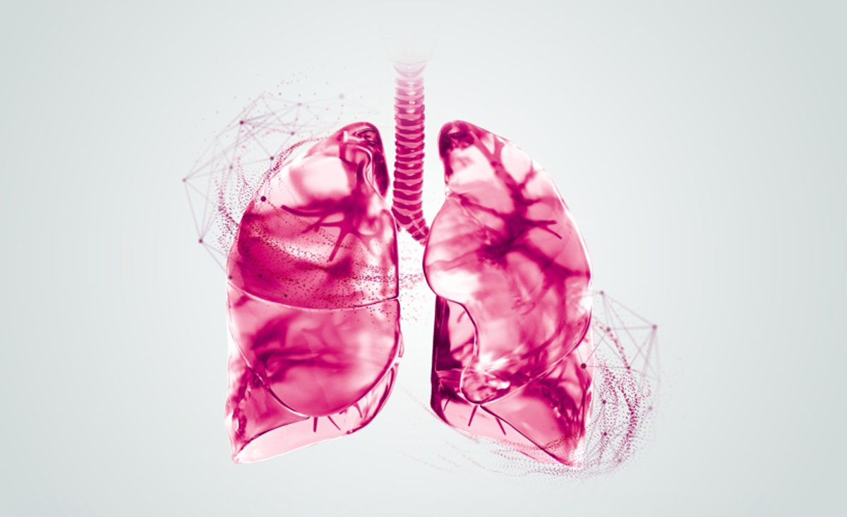 Lung Cancer
