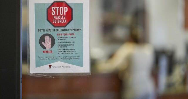 Canada has half as many measles cases as U.S.: WHO data | National News