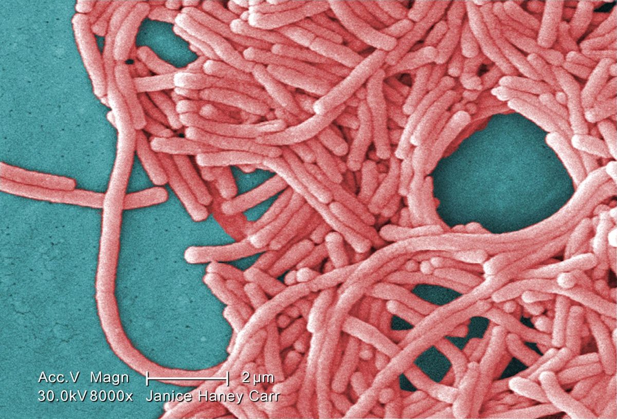 Toronto Public Health investigating legionnaires' disease outbreak near downtown core