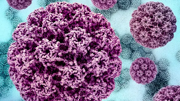 Computer Artwork: HP-Virus