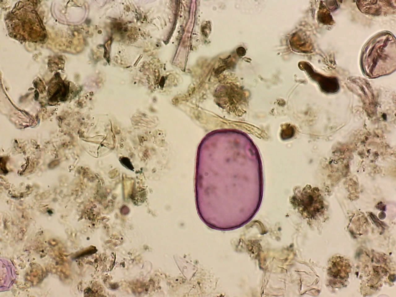 Roggenpollen (Secale cereale)
