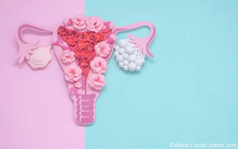 PCOS