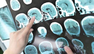 Erreur de diagnostic: le Tribunal fédéral condamne un médecin