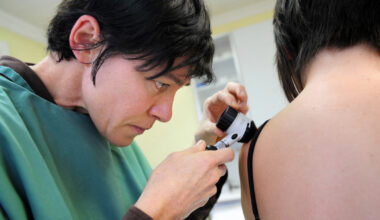Résultats positifs pour un vaccin contre le cancer de la peau