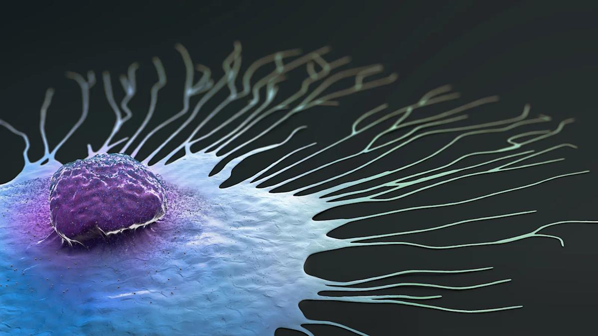 Roche’s prized breast cancer pill fails closely watched study