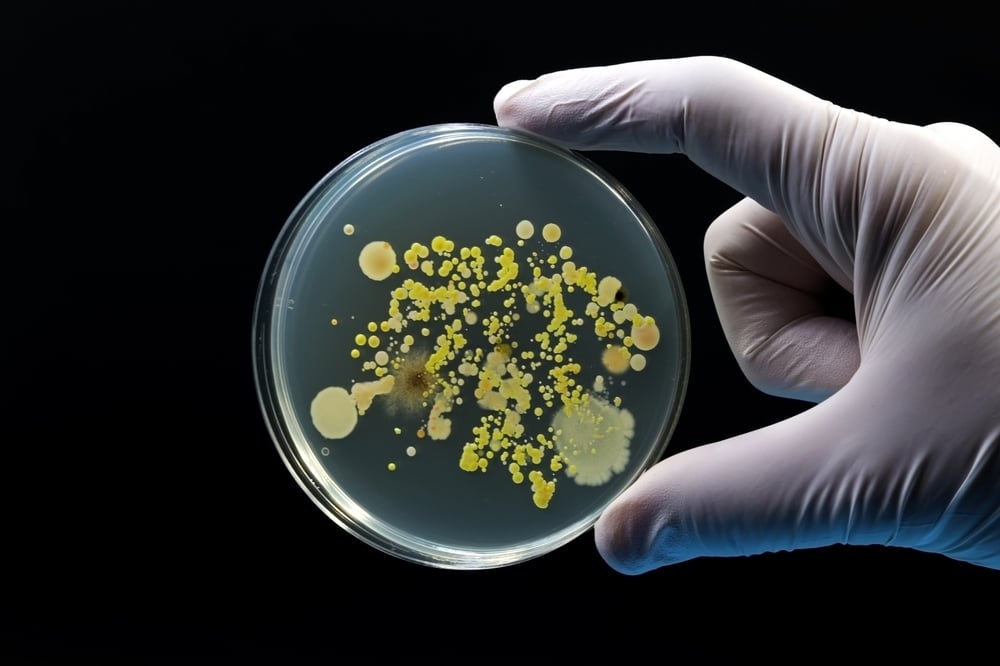 Lethal Hantavirus Outbreak Jumps From Cruise Ship To Switzerland: What Do Prediction Markets Say About A