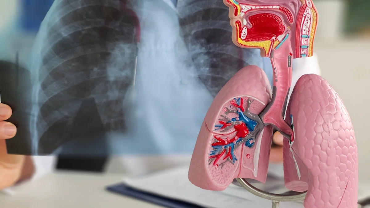 Roche secures CE Mark for Elecsys test to detect tuberculosis