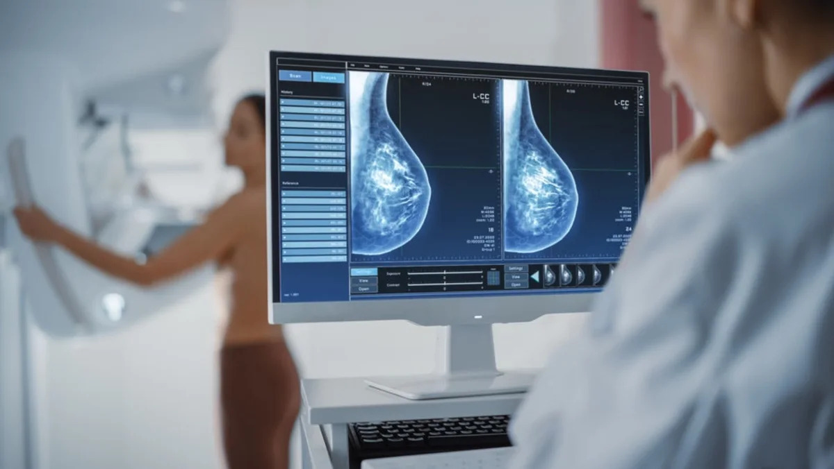 Roche pens $490m Astex breast cancer license deal