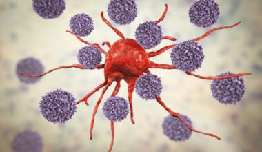 Roche Reports Positive Results From Head-to-Head Study on NSCLC Drug