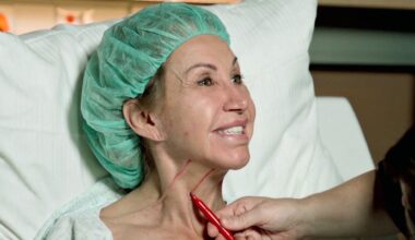 TV-Millionärin Carmen Geiss: 8 Stunden Gesichts-OP! 3 Chirurgen im Einsatz! | Unterhaltung