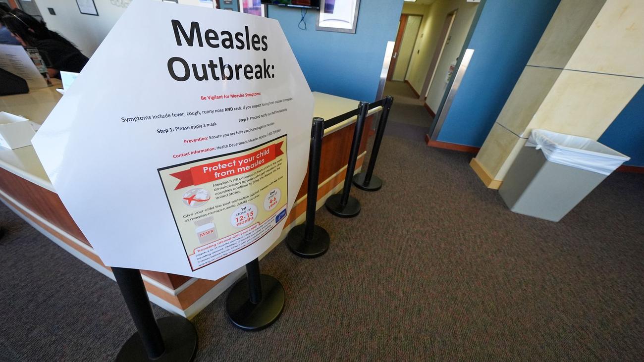 Gesundheit: Zweites Kind stirbt nach Masernausbruch in den USA