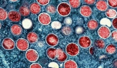 Zahl der Mpox-Fälle in Berlin steigen an