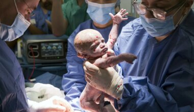 Großbritannien - Kleines Wunder: Baby nach Gebärmuttertransplantation geboren - Wissen