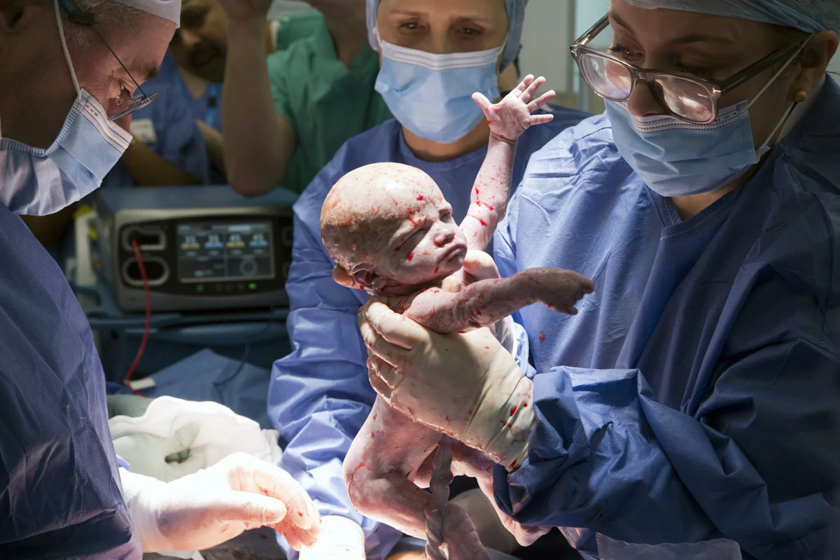 Großbritannien - Kleines Wunder: Baby nach Gebärmuttertransplantation geboren - Wissen