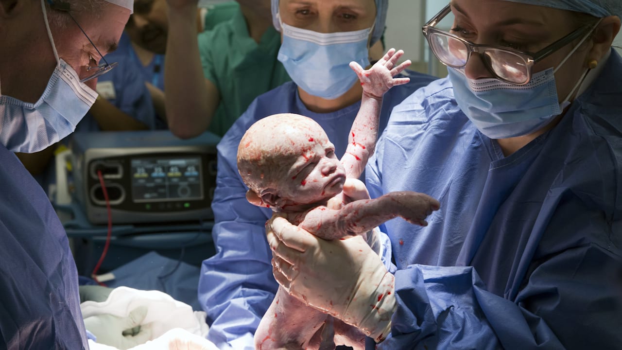 Transplantations-Wunder: Britin schenkt Schwester Gebärmutter – Baby Amy da! | Leben & Wissen