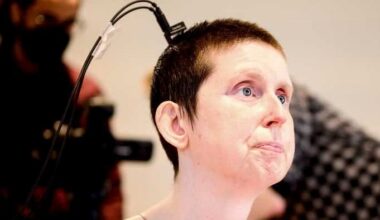 Schlaganfall: Dank Neuroprothese kann sie nach 18 Jahren wieder sprechen | Leben & Wissen