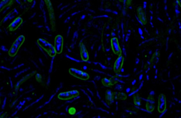 Studie: In Kroatiens Süßwasserseen horten „egoistische“ Bakterien Nährstoffe