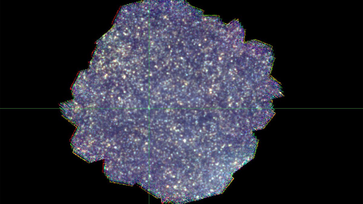 Rätsel der Astronomie gelöst? – Zu viele Galaxien in alten Aufnahmen entdeckt