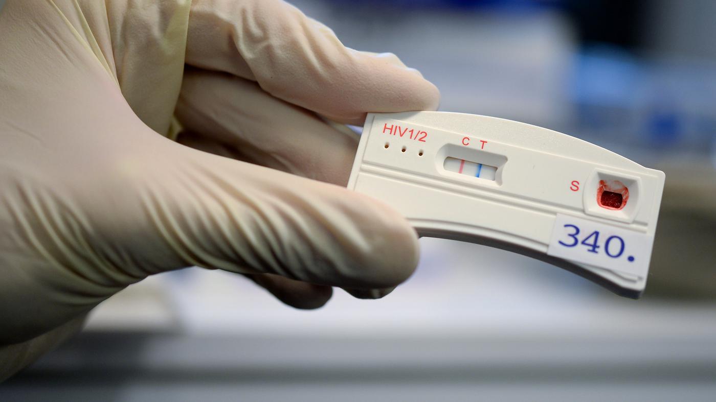 57.000 vermeidbare Todesfälle - pro Jahr: Teilziele im Kampf gegen HIV und Hepatitis verfehlt