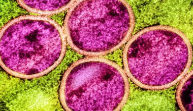 Mehr Mpox-Infektionen – Warnung vor Pandemie-Risiko