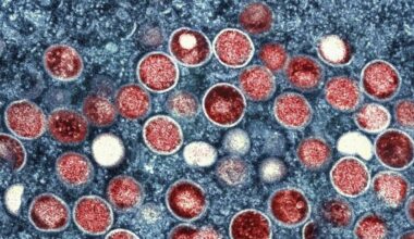 Berlin: Ungewöhnlich viele Mpox-Fälle gemeldet