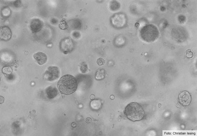 Mikroskopische Aufnahme von Kopf-Hals-Tumor-Organoiden in 3D-Kultur (Durchlicht, 10 X Objektiv). Foto: Christian Issing