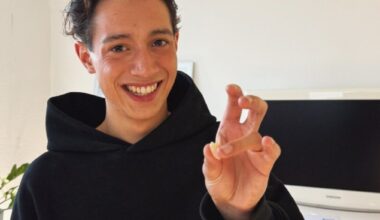 Erst Bühne, dann Bohrer – Schmerzhaftes Debüt für Norwegens ESC-Hoffnung Kyle Alessandro in Basel