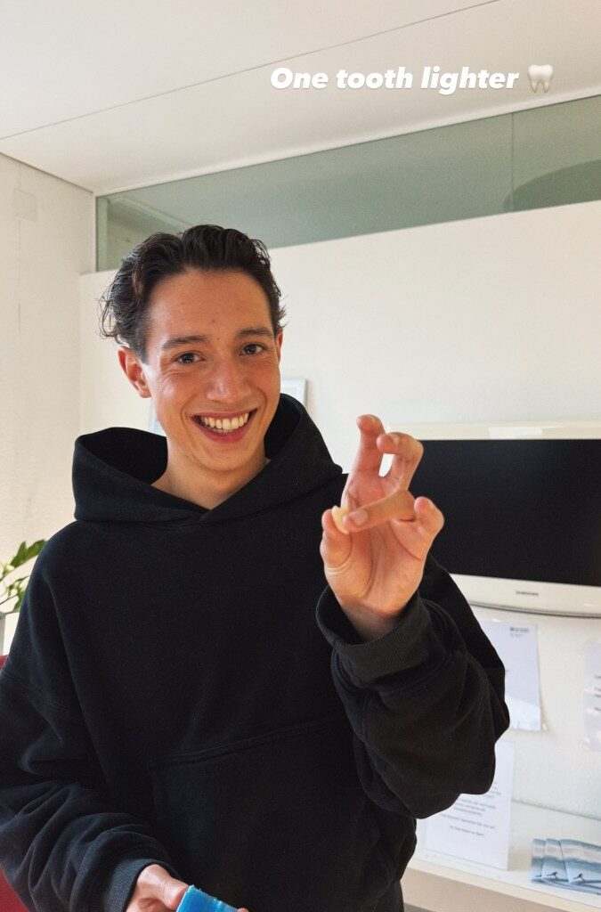 Erst Bühne, dann Bohrer – Schmerzhaftes Debüt für Norwegens ESC-Hoffnung Kyle Alessandro in Basel