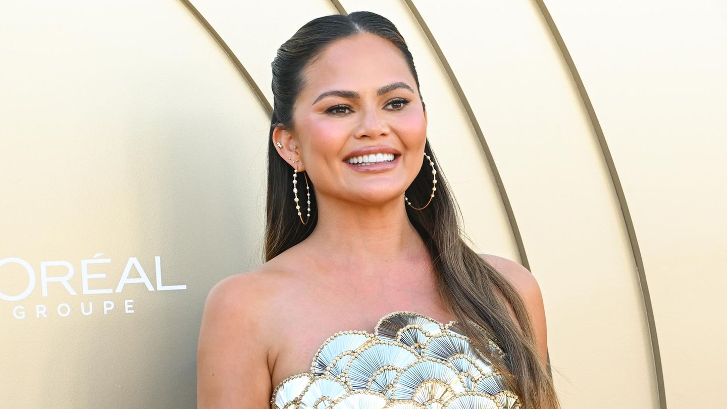 Chrissy Teigen: Sie hat sich die Stirn verkleinern lassen