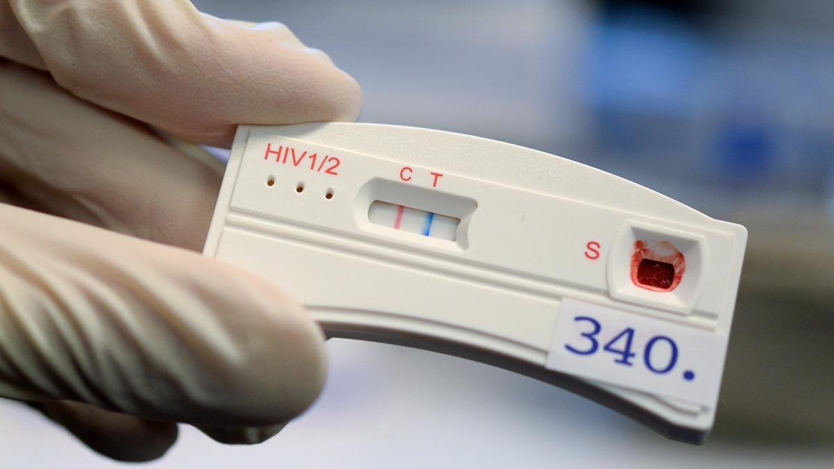 Aids, Syphilis, Gonorrhoe: Tripper wird in Europa immer mehr zum Problem