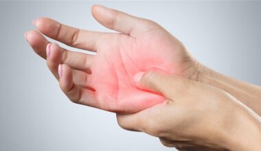Aktualisierte Empfehlungen zur Therapie von neuropathischen Schmerzen